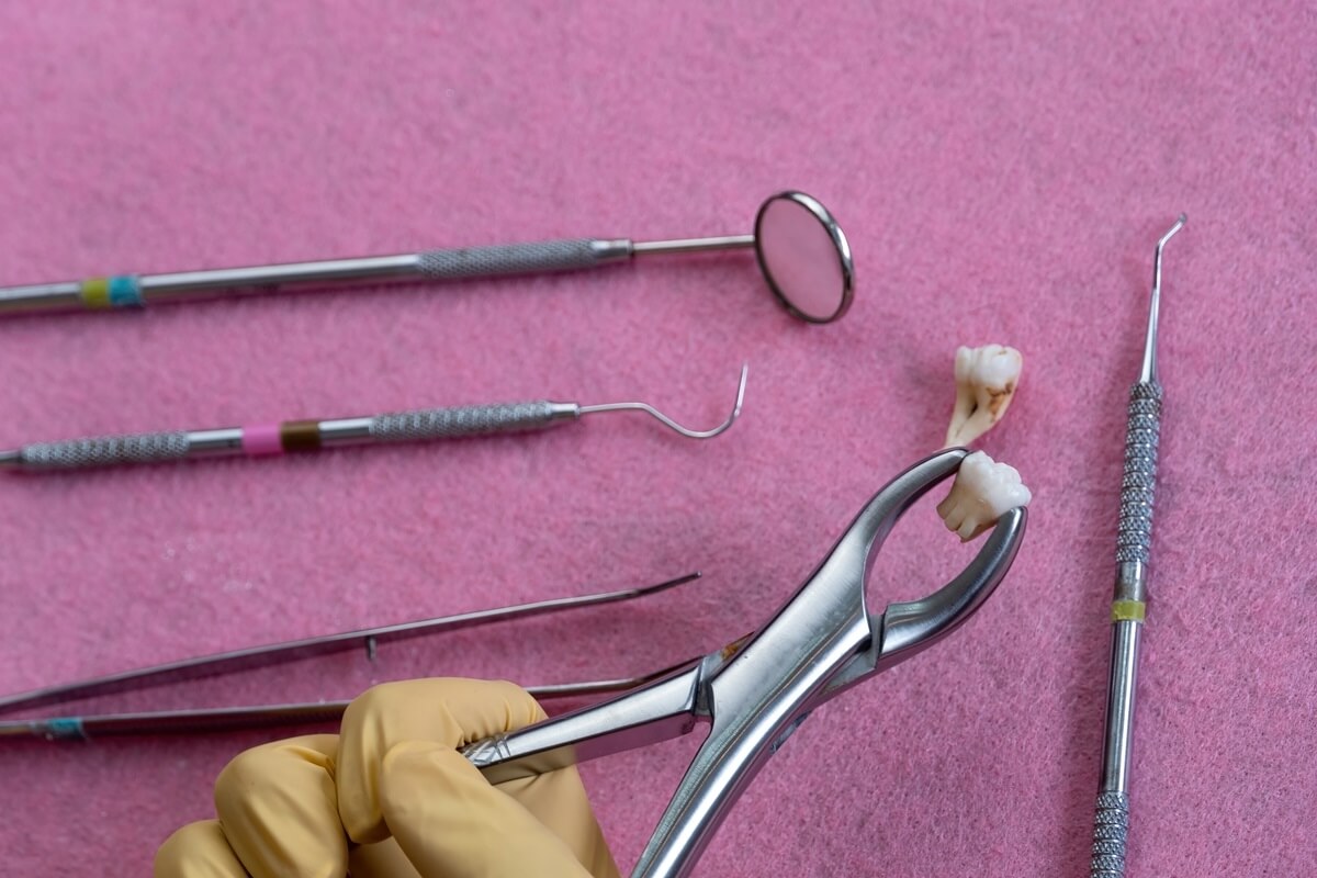 Usuwanie ósemek - narzędzia dentystyczne i model zęba