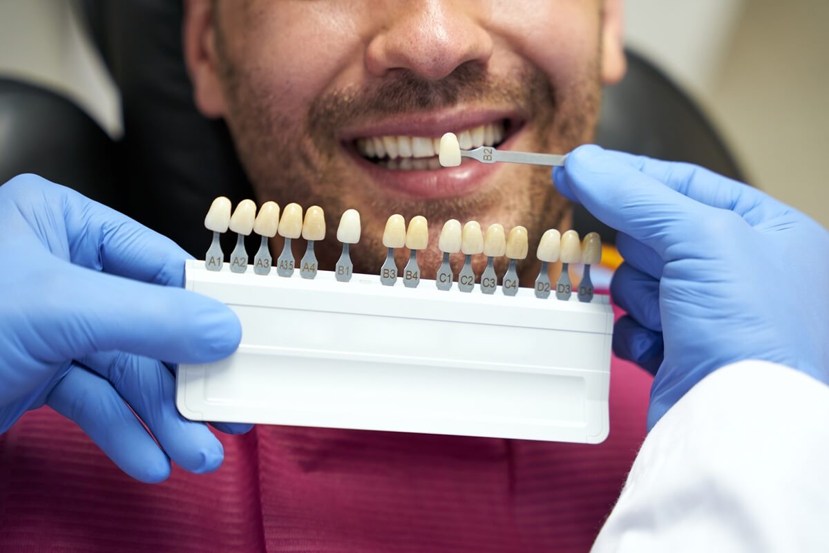 Licówki - dentysta dobierający kolor licówek do zębów pacjenta